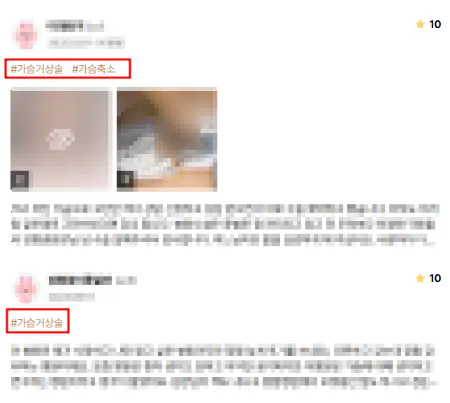 หน้าอกหย่อนคล้อยหลังคลอด — เข้าใจผิดว่าแค่เติมเต็มอกส่วนบนด้วยซิลิโคนก็พอ? — ภาพประกอบบทความ 8