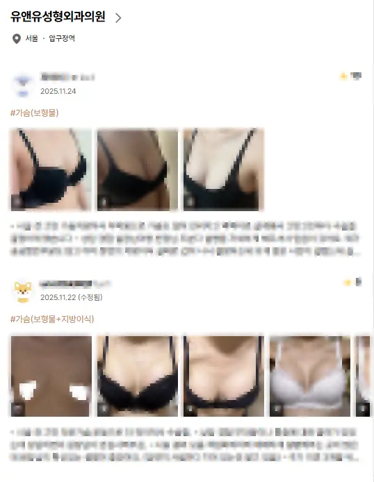 คลินิกเสริมหน้าอก? 2 สิ่งที่ต้องรู้เพื่อไม่ให้ถูกรีวิวหลอก <คำแนะนำจากประสบการณ์วิจัย 20 ปี> — ภาพประกอบบทความ 2