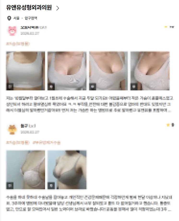 ค่าผ่าตัดยกกระชับหน้าอก? เหตุผลที่รู้ราคาก่อนก็ไม่มีความหมาย — ภาพประกอบบทความ 5