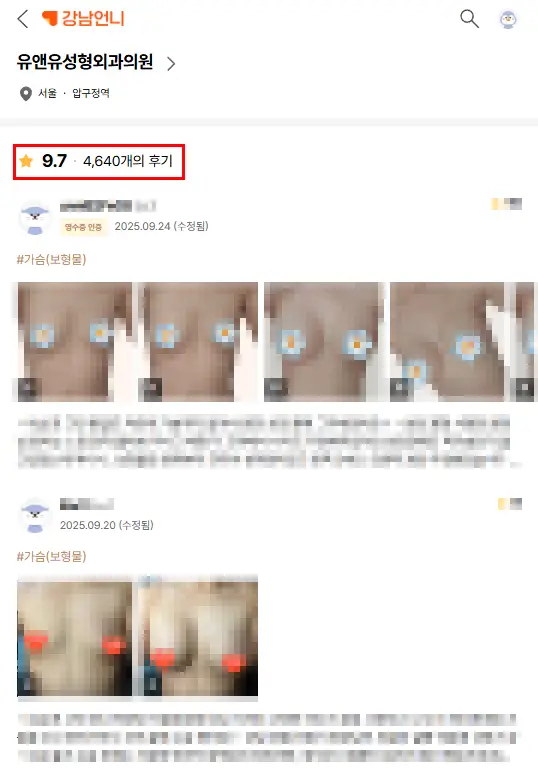 ถุงเต้านมเทียมแตก จำเป็นต้องทำ MRI เสมอไปหรือไม่? ตรวจด้วยอัลตราซาวด์ได้หรือเปล่า — ภาพประกอบบทความ 2