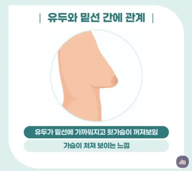 ค่าใช้จ่ายในการผ่าตัดยกกระชับหน้าอก ราคาเท่าไหร่? คลินิกที่ทำศัลยกรรมซิลิโคนหน้าอกถึง 3023 เคสเมื่อปีที่แล้วจะมาอธิบายให้ฟัง — ภาพประกอบบทความ 5