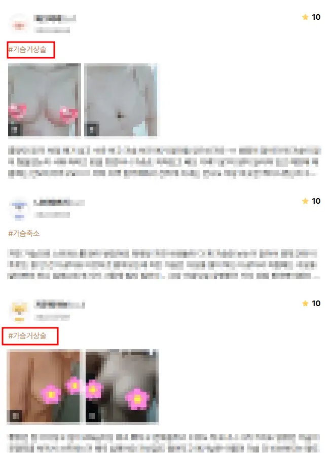 หน้าอกหย่อนคล้อยหลังคลอด — เข้าใจผิดว่าแค่เติมเต็มอกส่วนบนด้วยซิลิโคนก็พอ? — ภาพประกอบบทความ 9