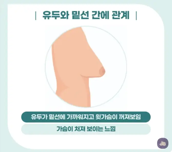 ค่าผ่าตัดหน้าอกหย่อนคล้อย? อย่าหลงเชื่อแม้แต่รีวิว — ภาพประกอบบทความ 4