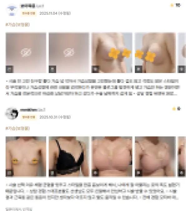 คลินิกเสริมหน้าอกย่านอัปกูจ็อง กับความเข้าใจผิดว่าแค่ดูรีวิวแพทย์ผู้ผ่าตัดแล้วไปได้เลย — 본문 이미지