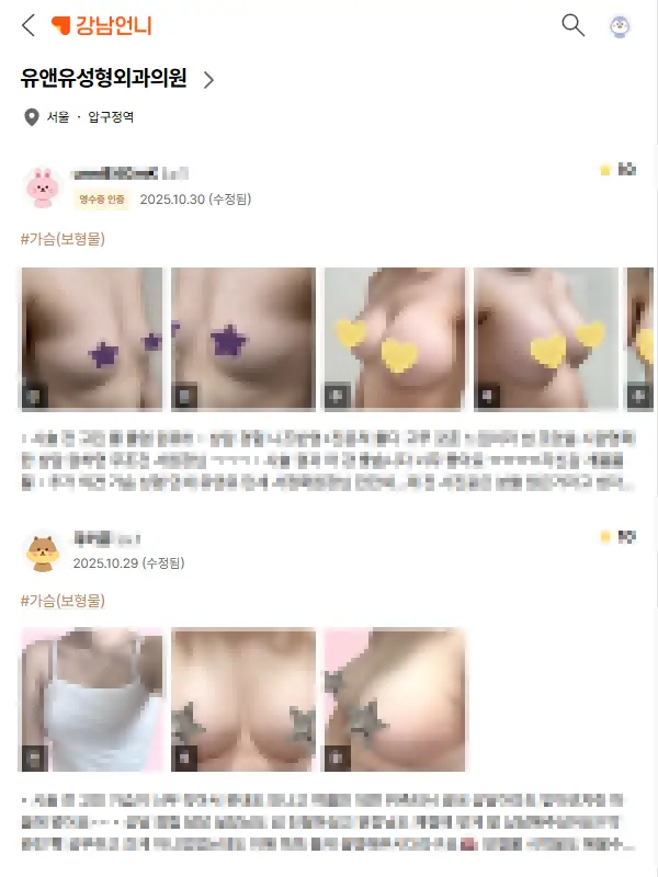 ประเภทของการเสริมหน้าอก? เราจะบอกให้ครบทุกอย่างจากประสบการณ์วิจัยตลอด 20 ปี — ภาพประกอบบทความ 6