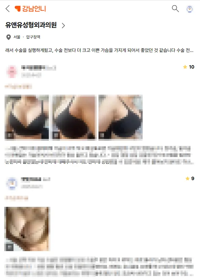 หน้าอกหย่อนคล้อยหลังผ่าตัด — ใส่ซิลิโคนแล้ว จะยิ่งหย่อนกว่าเดิมไหม? — ภาพประกอบบทความ 2