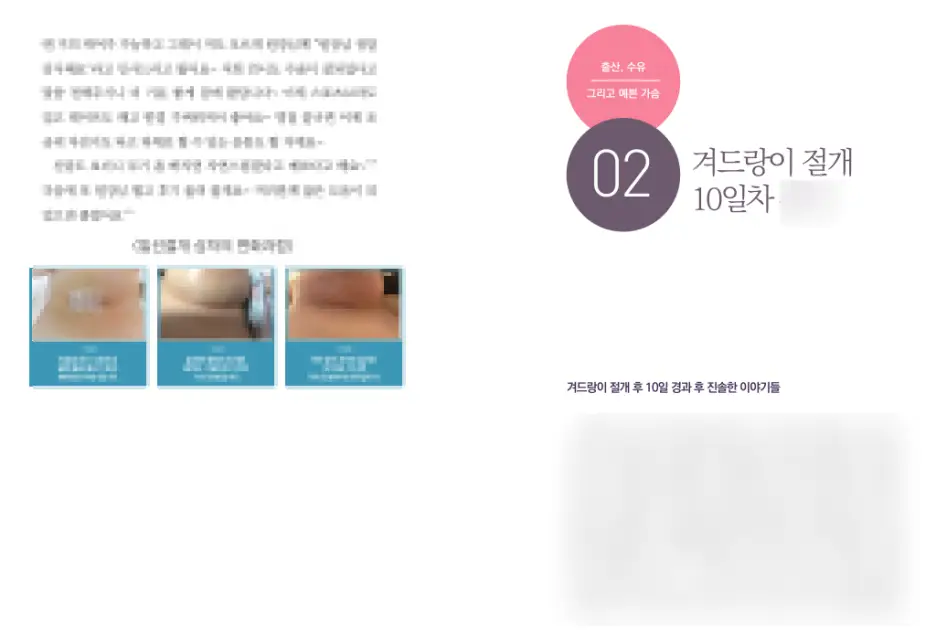 รีวิวศัลยกรรมหน้าอกหย่อนคล้อย? อย่าหลงเชื่อ — ภาพประกอบบทความ 6