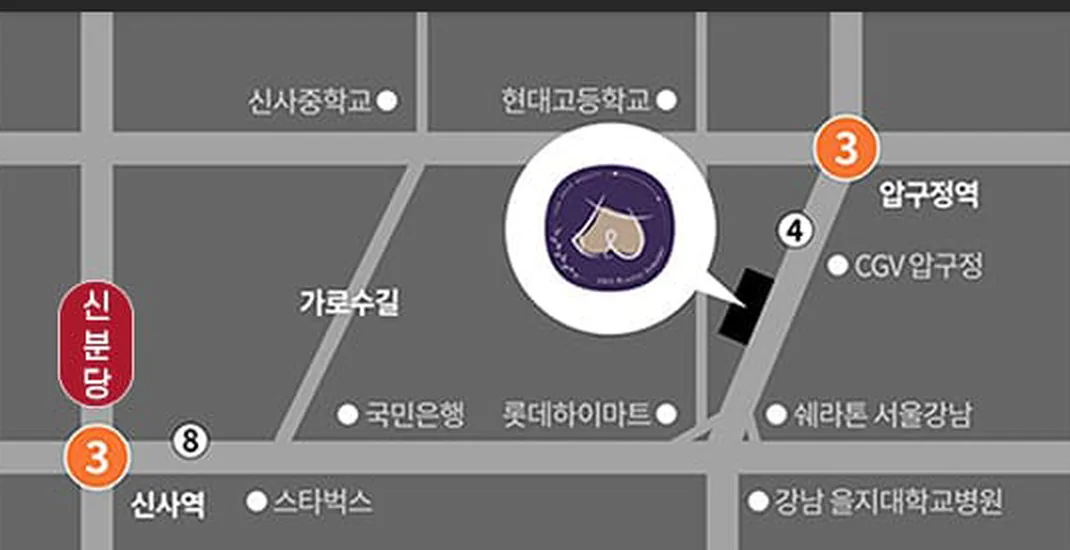 แผนที่คลินิกศัลยกรรมตกแต่ง U&U — ถนนคาโรซูกิล ใกล้สถานีอัปกูจองและสถานีชินซา