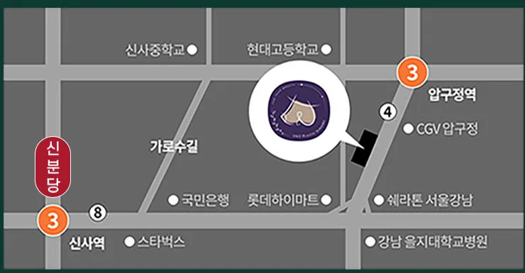 แผนที่คลินิกศัลยกรรมตกแต่ง U&U — เดิน 5 นาทีจากทางออก 4 สถานีอัปกูจอง ใกล้ถนนคาโรซูกิล