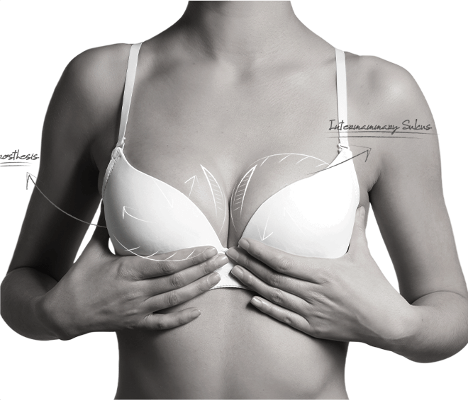 Happy Breast อบรมการใส่บรา img1 m