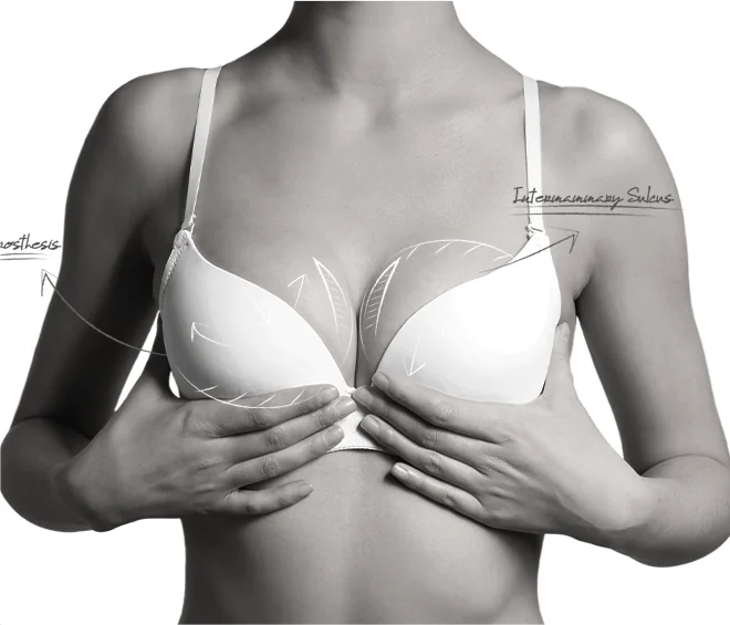 Happy Breast อบรมการใส่บรา img1 m