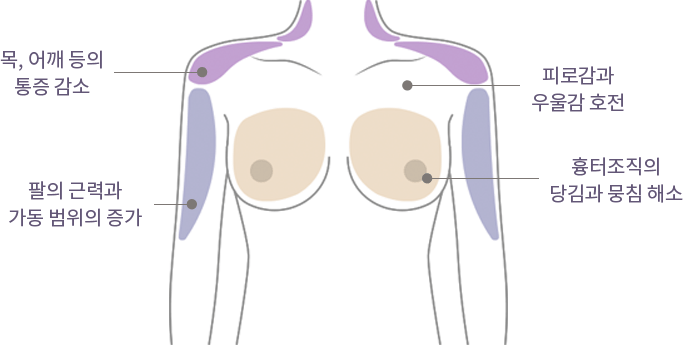 Happy Breast พิลาทิส img3 m