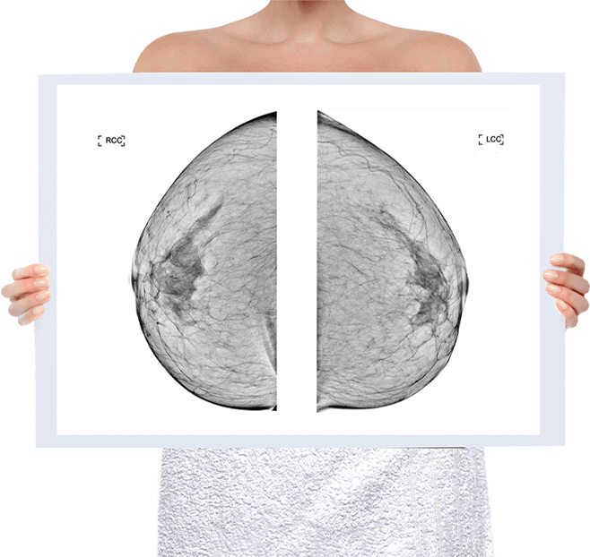 Healthy Breast แมมโมแกรม img5 m