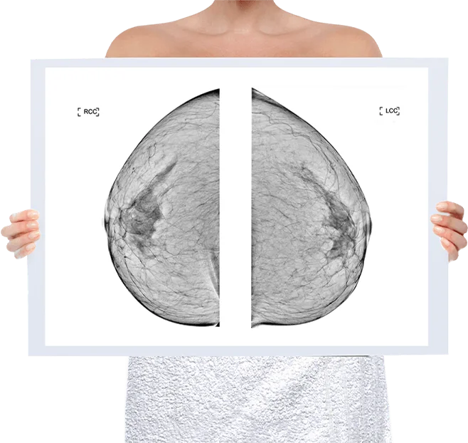 Healthy Breast แมมโมแกรม img5 m