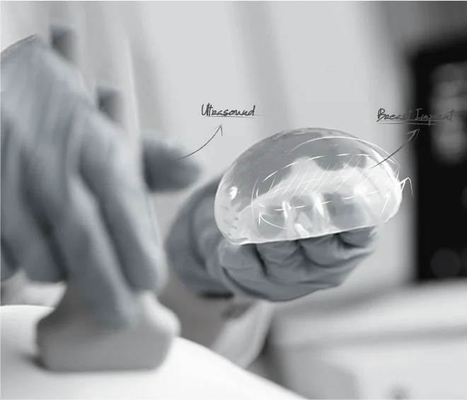 Healthy Breast อัลตราซาวนด์ซิลิโคน img1 m