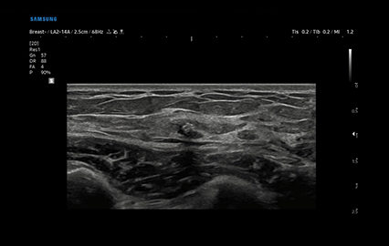 Healthy Breast อัลตราซาวนด์ซิลิโคน img5 m