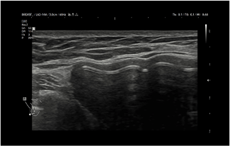Healthy Breast อัลตราซาวนด์ซิลิโคน img6 m