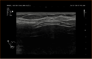 Healthy Breast อัลตราซาวนด์ซิลิโคน img7 m