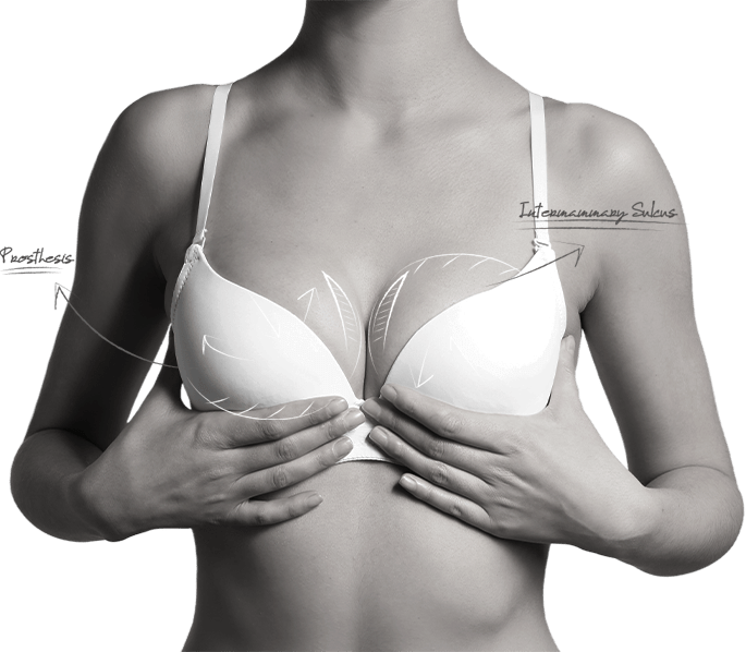 happy breast อบรมการใส่บรา img1