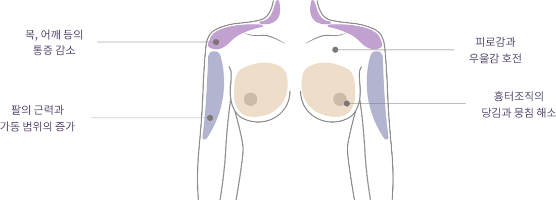 happy breast พิลาทิส img3