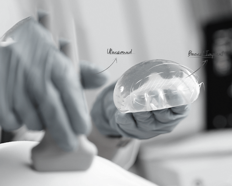 healthy breast อัลตราซาวนด์ซิลิโคน img12