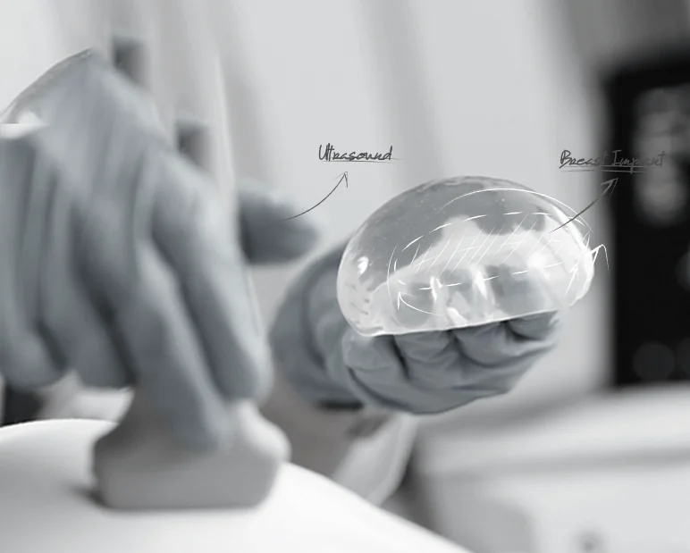 healthy breast อัลตราซาวนด์ซิลิโคน img12